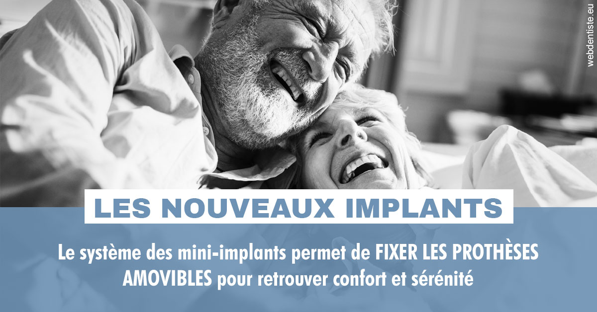 https://dr-patrice-drancourt.chirurgiens-dentistes.fr/Les nouveaux implants 2