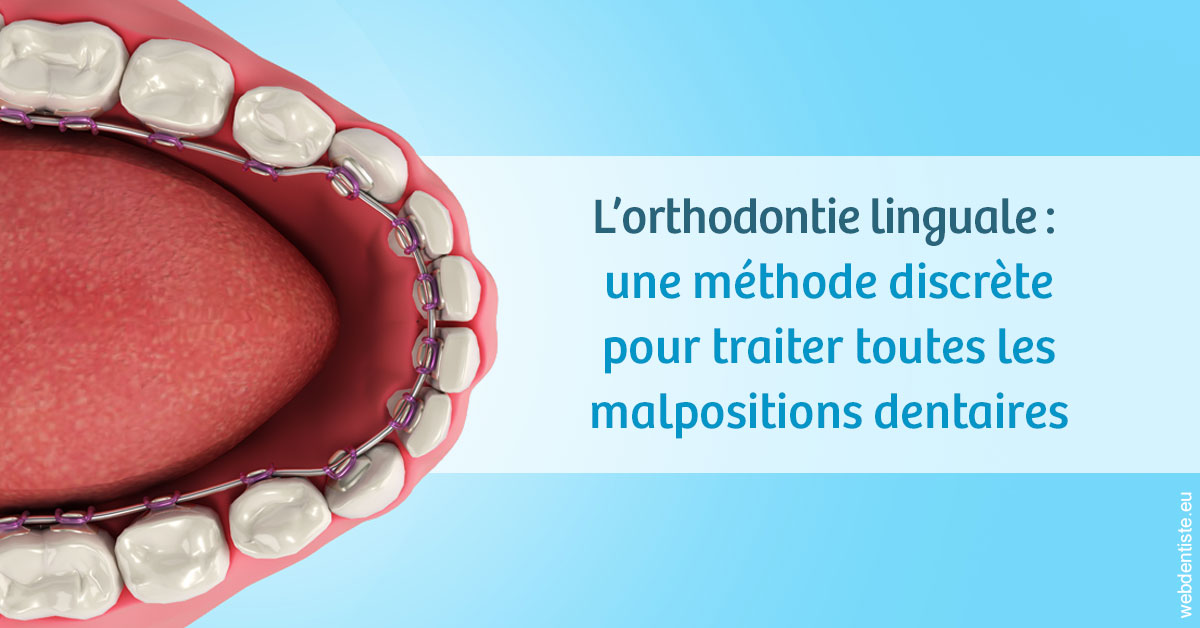 https://dr-patrice-drancourt.chirurgiens-dentistes.fr/L'orthodontie linguale 1
