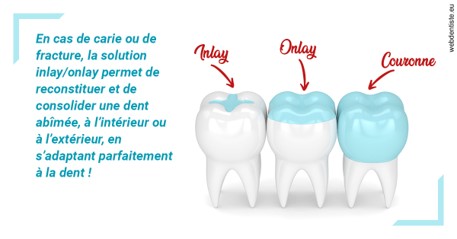 https://dr-patrice-drancourt.chirurgiens-dentistes.fr/L'INLAY ou l'ONLAY