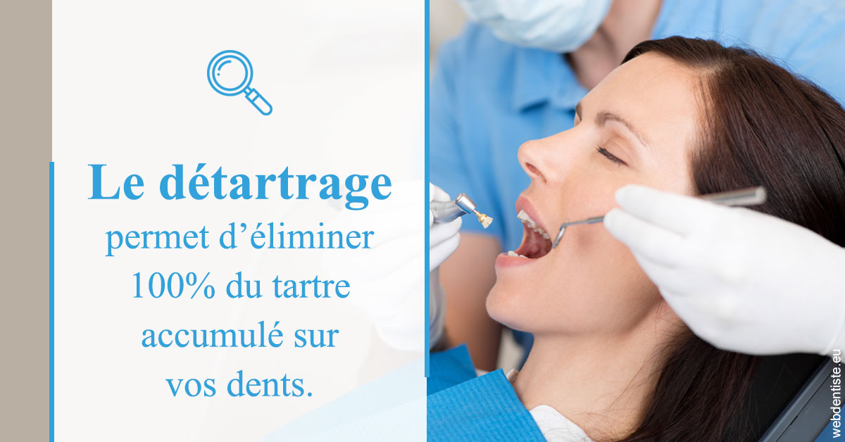 https://dr-patrice-drancourt.chirurgiens-dentistes.fr/En quoi consiste le détartrage