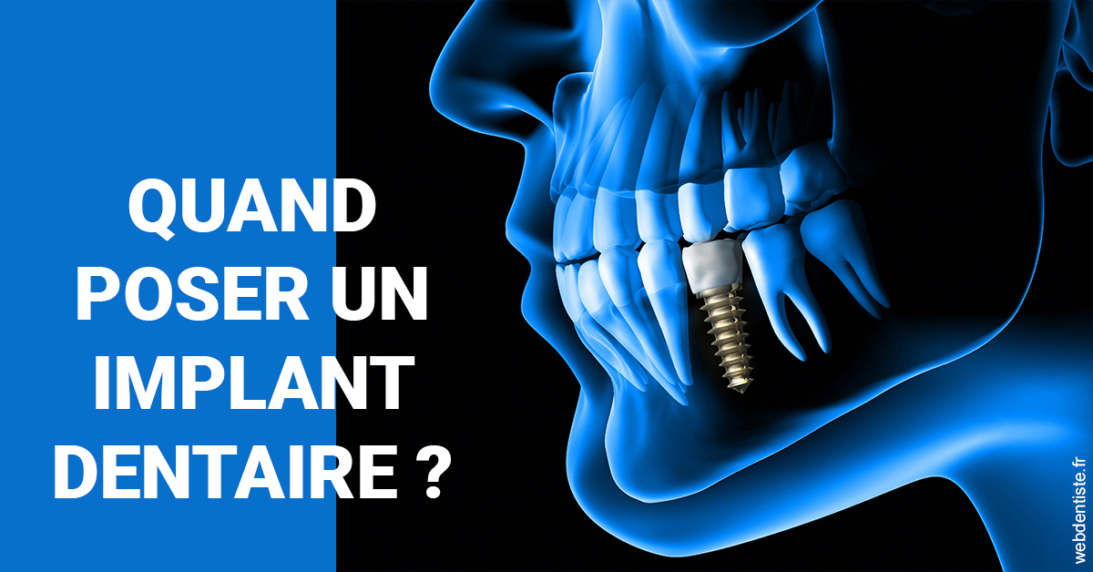 https://dr-patrice-drancourt.chirurgiens-dentistes.fr/Les implants 1