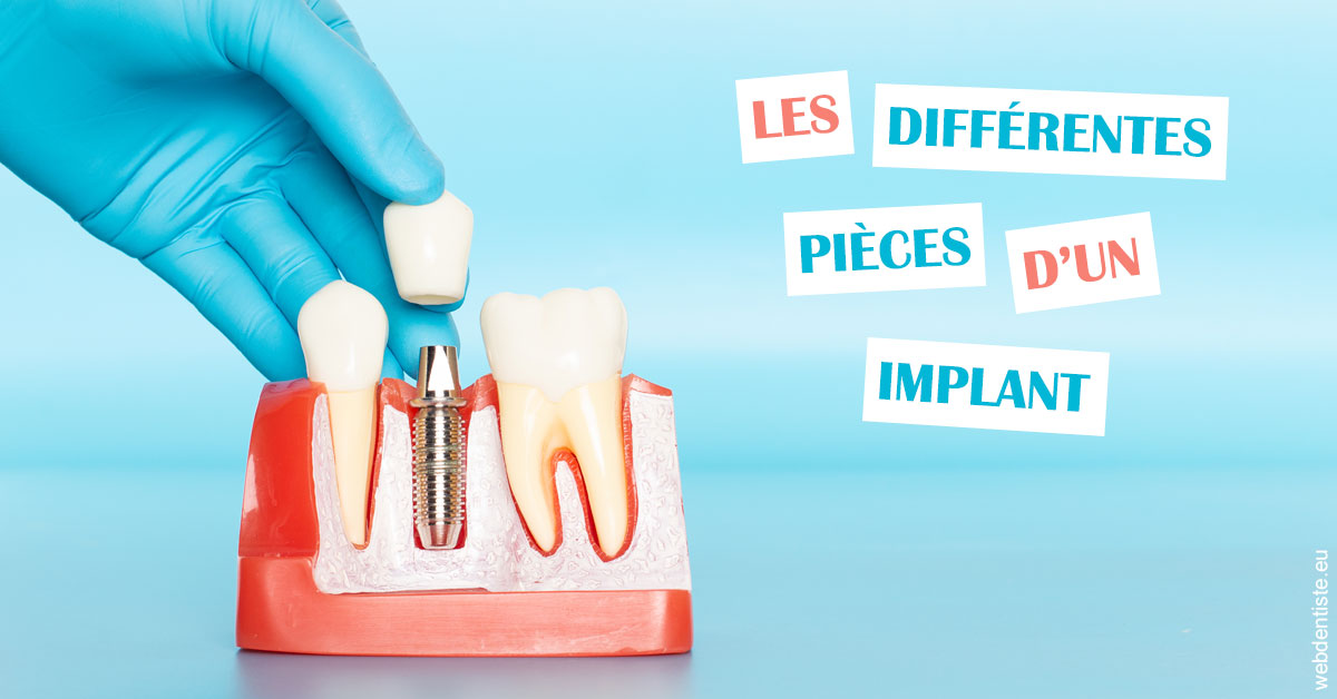 https://dr-patrice-drancourt.chirurgiens-dentistes.fr/Les différentes pièces d’un implant 2