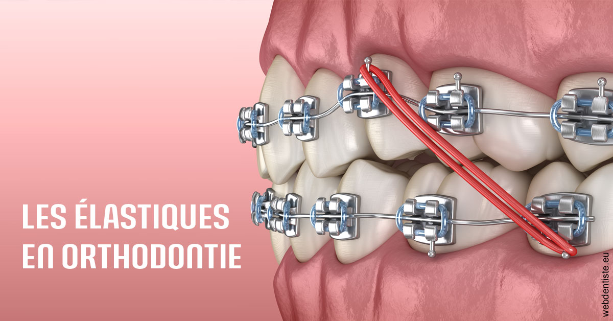 https://dr-patrice-drancourt.chirurgiens-dentistes.fr/Elastiques orthodontie 2