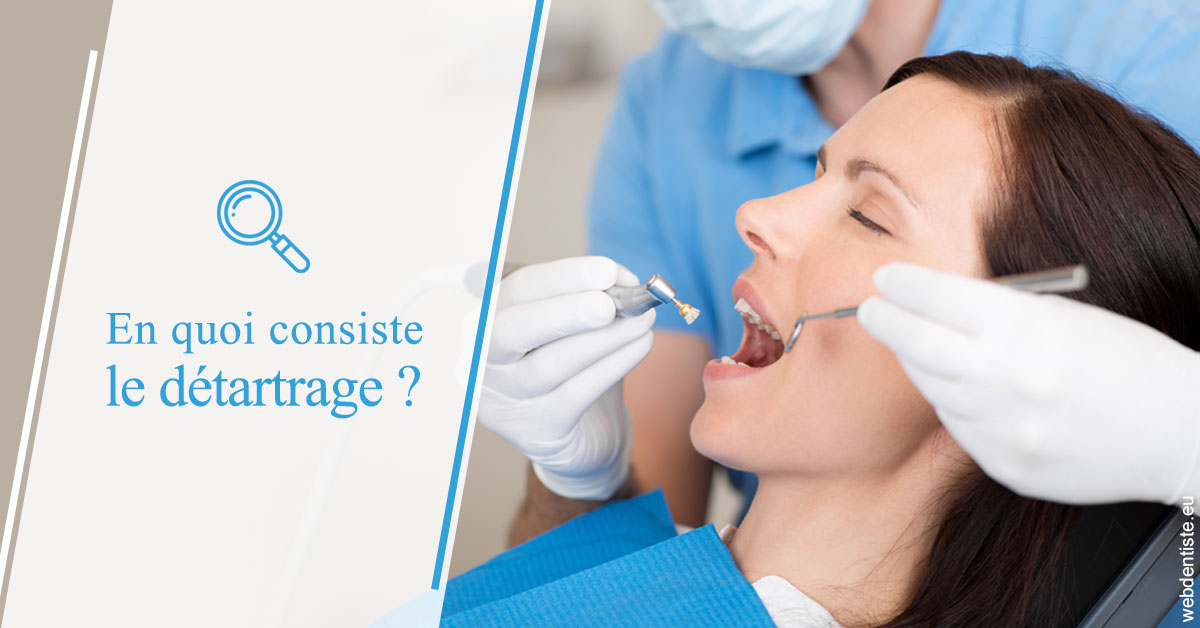 https://dr-patrice-drancourt.chirurgiens-dentistes.fr/En quoi consiste le détartrage