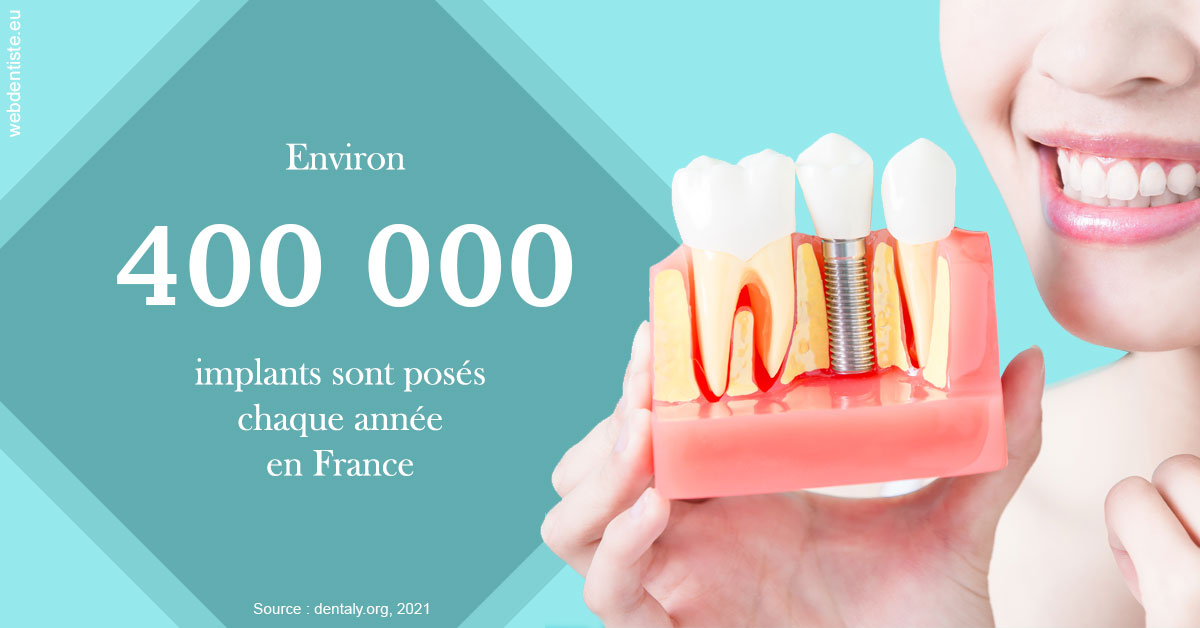 https://dr-patrice-drancourt.chirurgiens-dentistes.fr/Pose d'implants en France 2